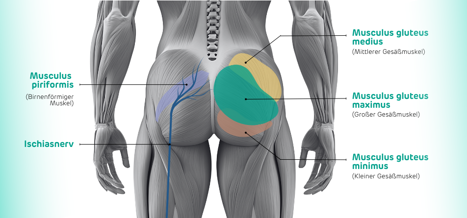 Infografik Anatomie Gesäß zur Aufklärung von Gesäßschmerzen